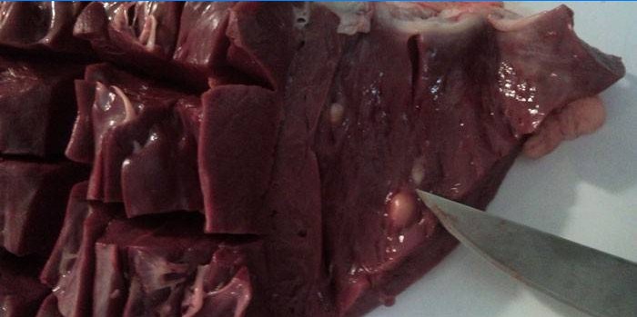 Žalios mėsos cisticerkozė