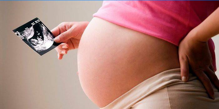 Nėščia moteris po ultragarso